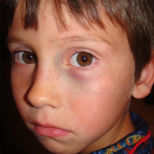 picoct07 001